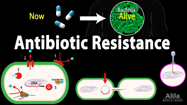 مقاومة البكتيريا للمضادات الحيوية