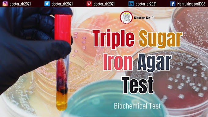 Triple sugar Iron agar (TSIA) Test - Overview