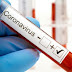 Ilhéus: Justiça obriga Cassi a custear testes para detectar coronavírus