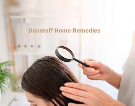 image show Dandruff Home Remedies