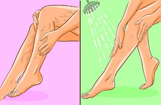 Какво трябва да знаете за разширените  вени и болките в краката