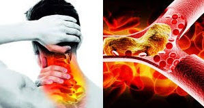 10 #Symptoms Of #High #Cholesterol That You #Shouldn't #Ignore 