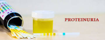 Proteinuria Ayurvedic Treatment