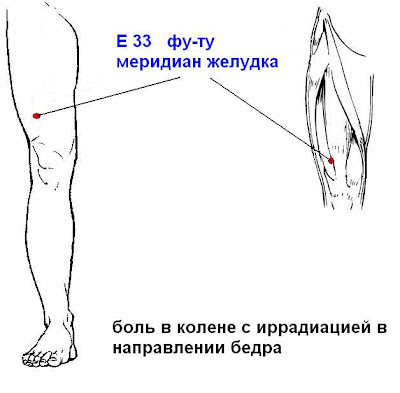 Иррадиация боли в ногу