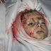 Foto Anak Suriah Yang Tewas Terkena Bom Dan Rudal