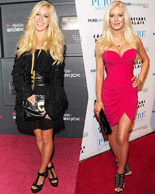heidi montag before and after. heidi montag before and after.