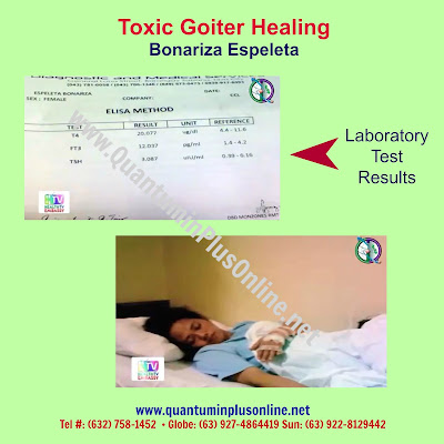 Toxic Goiter: Quantumin Plus Healing