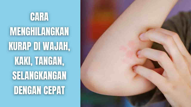 Gatal Kurap? Ini Cara Menghilangkan Kurap dan Obat Salep Kurap Apa Itu Kurap? Kurap atau Ringworm adalah infeksi kulit yang disebabkan oleh jamur, seperti jamur yang hidup di jaringan kulit mati atau daki, rambut, dan kuku. Ketika mengalaminya di jari-jari kaki, ini disebut athlete’s foot. Jika menyebar ke selangkangan, ini disebut jock itch.    Penyebab Kurap Memang penyebab penyakit kurap adalah jamur, namun jamur jenis ini secara alami hidup di kulit, rambut, dan kuku. Akan tetapi, jika lingkungan mereka menjadi panas dan lembap, jamur mulai tumbuh tak terkendali. Disamping itu bisa terkena infeksi ini setiap kali kulit bersentuhan dengan jamur kurap di kulit orang lain.    Jenis Kurap Ada beberapa jenis kurap, penamaannya didasarkan oleh tempat kemunculannya di tubuh dan memang sebarnya kurap dapat muncul di mana saja. Jenis infeksi kurap seperti:  Kurap Kulit Kepala atau Tinea Capitis Kurap di kepala dapat menyebabkan bintik-bintik botak bersisik, merah, dan gatal di kulit kepala. Jika tidak diobati, bintik-bintik botak bisa tumbuh lebih besar dan menjadi permanen.  Tangan atau Tinea Manuum Kurap di tangan menyebabkan telapak tangan kering, pecah-pecah dan bercak seperti cincin.  Kaki Atlet atau Tinea Pedis Kurap di kaki menyebabkan ruam kulit yang gatal dan terbakar di antara jari-jari kaki dan telapak kaki. Kulit mungkin menjadi bersisik dan pecah-pecah atau melepuh. Dalam kasus yang jarang, kaki berbau tidak sedap.  Jock Itch atau Tinea Cruris Kurap di selangkangan, paha atas, atau rektum atau anus menyebabkan ruam merah dan gatal. Beberapa orang mengalami lecet.  Jenggot atau Tinea Barbae Kurap yang muncul di leher, dagu, dan pipi ini menyebabkan kulit berkerak atau berisi nanah.  Kuku Kaki dan Kuku Tangan atau Tinea Unguium atau Onikomikosis Kurap di kuku menyebabkan kuku menjadi tebal, berubah warna dan berubah bentuk.    Gejala Gejala kurap sangat bervariasi, yang meliputi:  Rasa gatal Bercak gatal dan berisisik warna merah, coklatk, abu-abu, atau area kulit yang menonjol yang disebut plak Kulit gatal yang bulat dan rata Tambahan yang mengembangkan lepuh atau pustula Tambahan yang menyerupai cincin dengan warna lebih dalam di bagian luar Tambahan dengan tepi yang ditentukan dan dinaikkan Cincin yang tumpang tindih Rambut rontok Kurap dapat terlihat berbeda tergantung pada bagian tubuh mana yang terkena.    Obat Kurap atau Salep kurap Beberapa obat antijamur yang dijual bebas atau OTC (over-the-counter) tersedia untuk mengobati kurap. Antijamur tersedia dalam berbagai bentuk seperi salep atau krim, gel, atau bubuk.  Salep, Krim, dan Antijamur Krim, gel, atau bubuk antijamur yang dijual bebas biasanya bekerja dengan baik meliputi:  Tolnaftat Terbinafine Mikonazol Klotrimazol Sampo Antijamur Shampo antijamur, seperti sampo ketokonazol dapat menghentikan penyebaran kurap kulit kepala. Sampo anti jamur tidak menyembuhkan kurap di kulit kepala, namun dapat membantu menahan infeksi jamur. Jadi perlu minum obat oral khusus kurap yang diresepkan oleh dokter.    Cara Menghilangkan Kurap Ada beberapa obat rumahan atau cara menghilangkan kurap secara alami atau obat kurap alami, diantaranya:  Minyak kelapa. Mengoleskan minyak kelapa ke kulit dapat mengurangi kejadian infeksi kurap. Ulangi mengoleskan minyak kalapa satu hingga tiga kali sehari. Kunyit. Kunyit bersifat antijamur. Cara menggunakannya menghaluskan kunyit sampai lembut, untuk mengoleskannya ke kurap. Ulangi mengoleskan minyak kalapa satu hingga tiga kali sehari.   Cara Mencegah Terkena Kurap Ada beberapa pencegahan yang dapat dilakukan untuk mencegah terkena kurap, diantaranya:  Jaga kulit tetap bersih dan kering Memakai sandal jepit di ruang loker dan kamar mandi umum Ganti kaus kaki dan pakaian dalam setiap hari Jangan berbagi pakaian atau handuk dengan penderita kurap Jika bermain olahraga, jaga kebersihan peralatan dan seragam dan jangan membaginya atau meminjamkannya dengan pemain lain. Cuci tangan dengan sabun dan air setelah bermain dengan hewan peliharaan. Jika hewan peliharaan menderita kurap, segera bawa ke dokter spesialis hewan. Untuk mengobati hewan peliharaan.