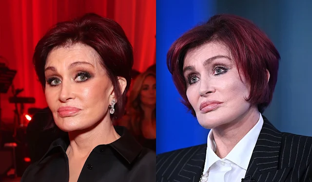 Sharon Osbourne Quits Plastic Surgery After 'Cyclops' Facelift