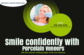 Porcelain Veneers In Brooklyn NY