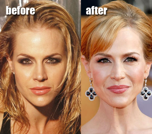 anna faris plastic surgery before after. Julie Benz efore and after