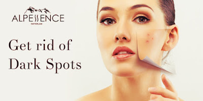 dark spot remover cream