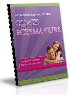 eczema cure . type of cure