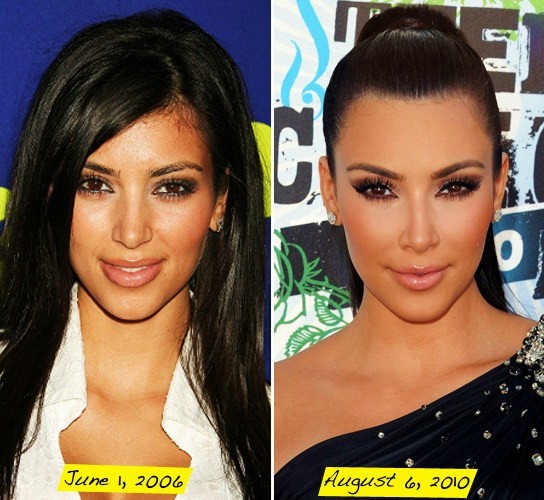 star's plastic surgery before and after photos. Kim Kardashian is one of