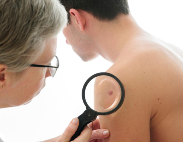 What are the Signs of Skin Infections