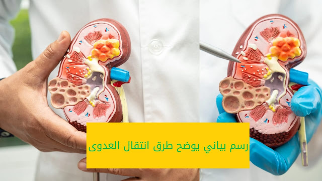 رسم بياني يوضح طرق انتقال الأمراض المنقولة جنسياً.