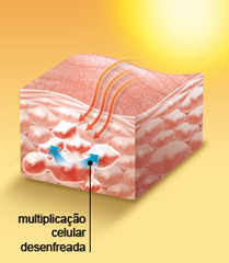 Pele descasca 2