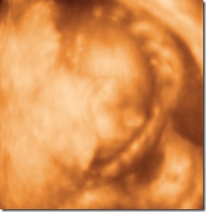 BABY GIRL_21