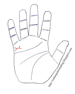 Separation Due to Abroad Travel In Palmistry