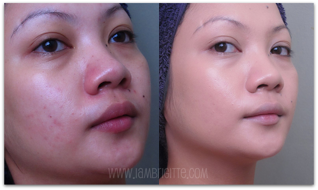 before and after foundation. efore and after