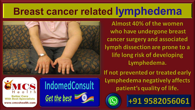 Breast cancer treatments in India, Best Indian breast cancer treatment hospitals , Best Indian breast cancer doctors,Indomedconsult,CMCS Health.