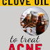 How to Use Clove Oil for Acne ?