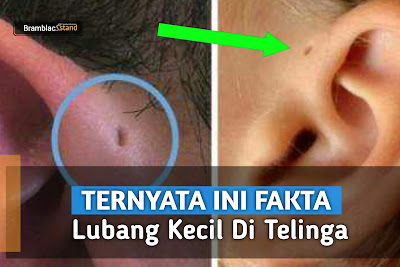 Ternyata ini Fakta Lubang Kecil Di Telinga 