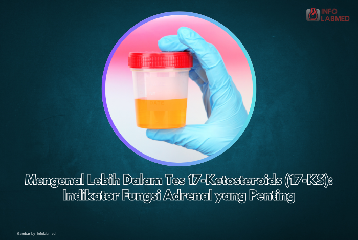 Mengenal Lebih Dalam Tes 17-Ketosteroids (17-KS) Indikator Fungsi Adrenal yang Penting