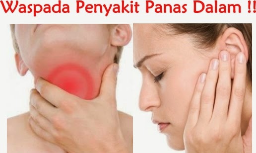 Pengobatan Terbaik Untuk Panas Dalam