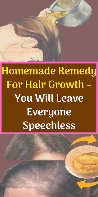 Homemade Remedy For Hair Growth – You Will Leave Everyone Speechless