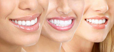 Sử dụng miếng dán tẩy trắng răng crest tẩy trắng răng