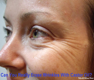 Can You Really Erase Wrinkles With Castor Oil?