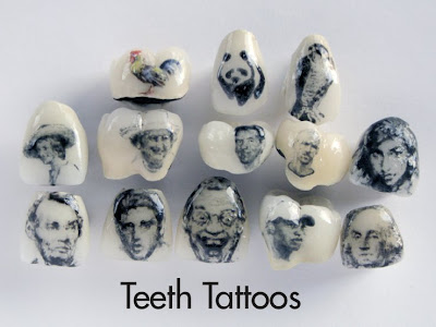 Teeth Tattoos: Heward Dental Lab has been in the crown and bridge business 