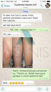 azanis scar serum testimoni review