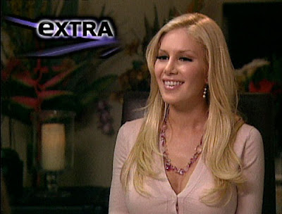 heidi montag after surgery 2010. Recent plastic surgery