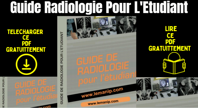Guide Radiologie Pour L'Etudiant pdf Gratuit