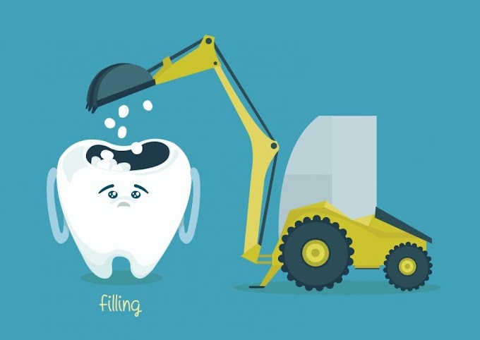 Tooth Coloured Fillings in India More Affordable Now