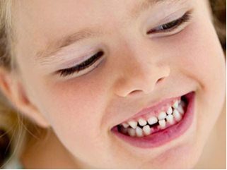 How Dental Damage Can Disappear With Dental Veneers?