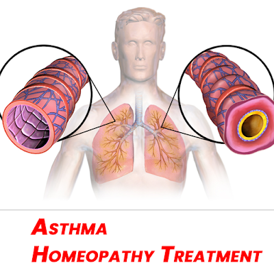 homoeopathic treatment for asthma
