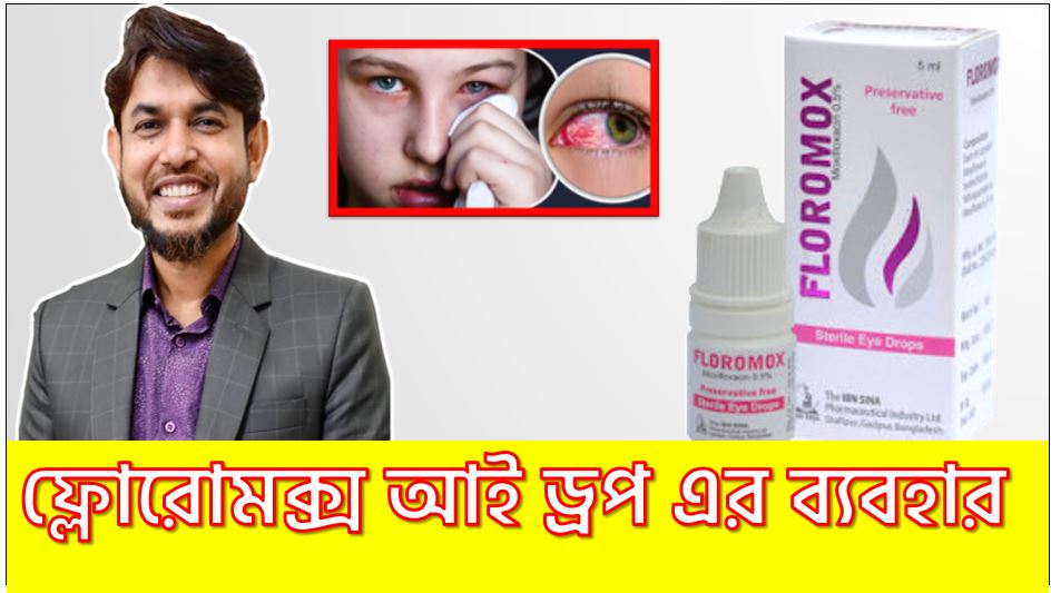 floromox eye drops bangla,ফ্লোরোমক্স আই ড্রপ এর ব্যবহার, ফ্লোরোমক্স আই ড্রপ এর উপকারিতা কি কি?,চোখ ওঠার ড্রপ ফ্লোরোমক্স,