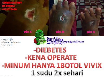 testimoni vivix, vivix untuk kencing manis, vivix untuk diabetes