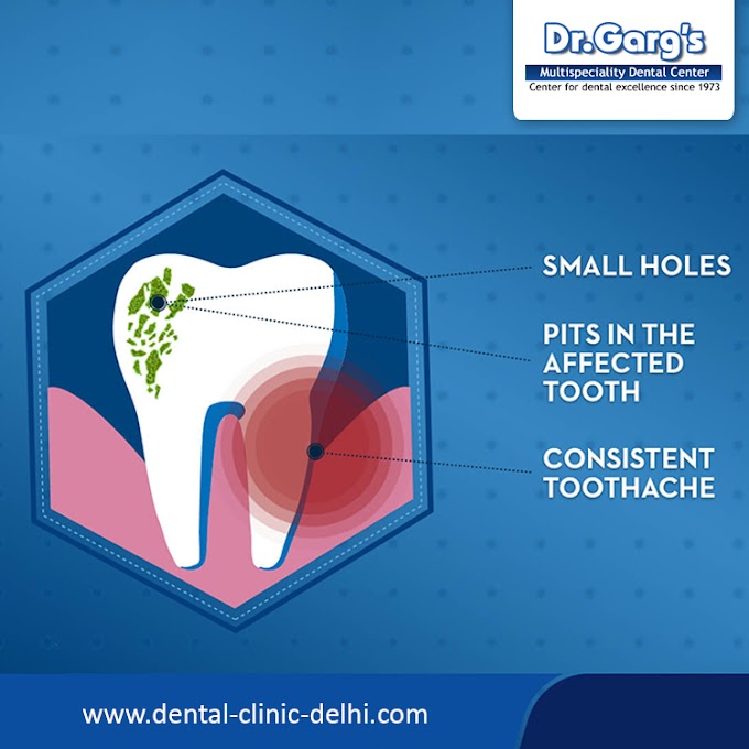 How to Get Bottle Tooth Decay Treatment?