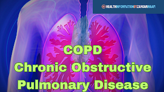 Understanding COPD ( Emphysema) Its symptoms and treatment