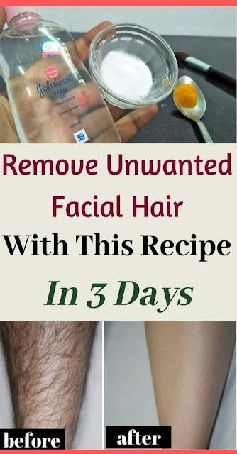 Remove Unwanted Facial Hair Permanently with This Recipe