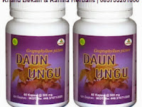 Pengobatan Obat Wasir Luar