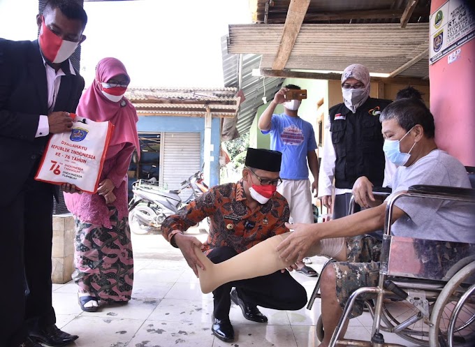 Wakil Walikota Serahkan Bantuan Kaki Palsu Warga Pasir Putih