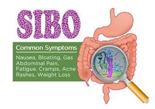 What is Small Intestinal Bacterial Overgrowth (SIBO)