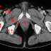 Ct Anatomy Pelvis Muscles - Imaging anatomy dislocation of the hip joint : Although ultrasound is frequently indicated for the primary.