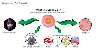 Stem Cell Therapy In Scottsdale