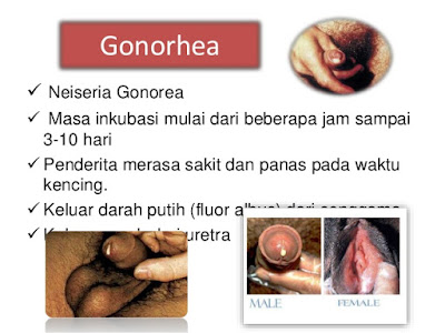 http://obatherbaldenatureindo.blogspot.com/2017/05/resep-obat-tradisional-untuk-kencing.html